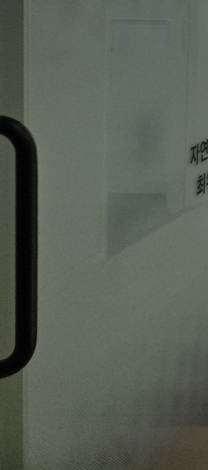 윗니만 교정 간단하게 끝내려면 관련 이미지 20