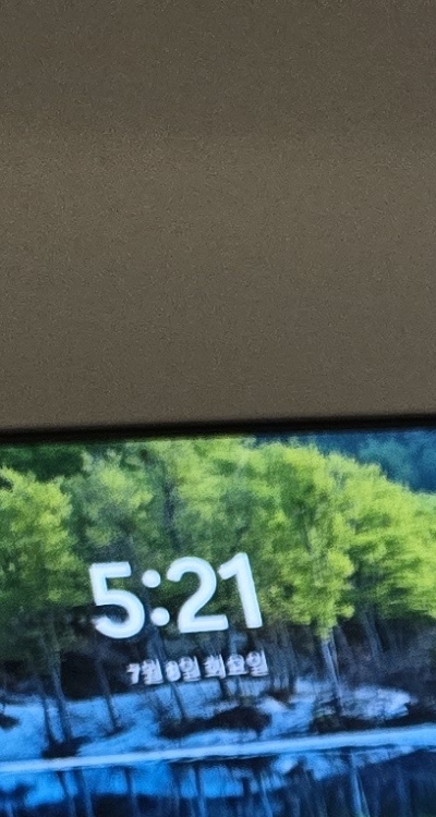 신경치료 아픈가요 망설이시는 분들이라면 관련 이미지 12