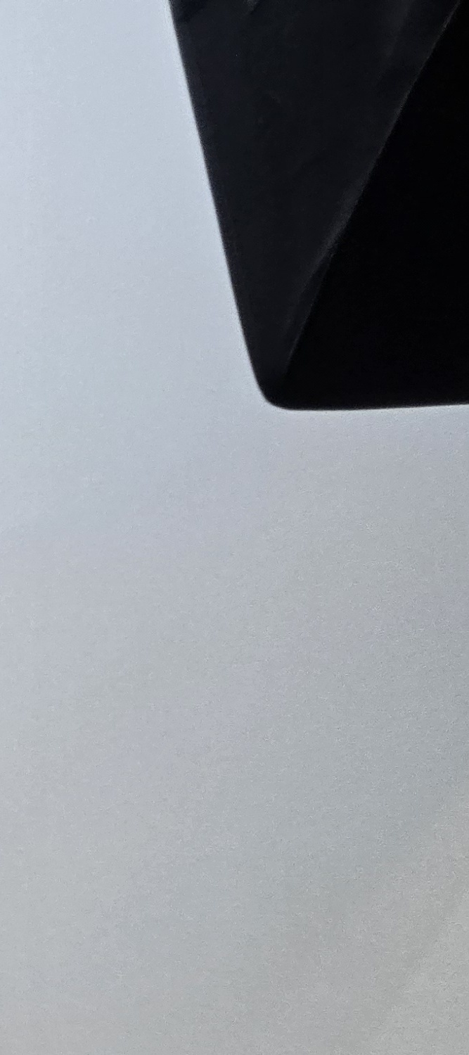 금 크라운 수명 몇년이나 지속될까요 관련 이미지 27