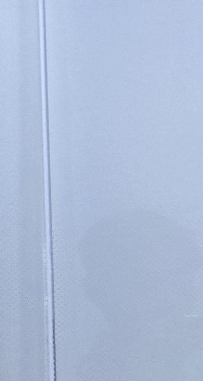 사랑니 발치 후 충치 치료 둘다 준비하려면 관련 이미지 21