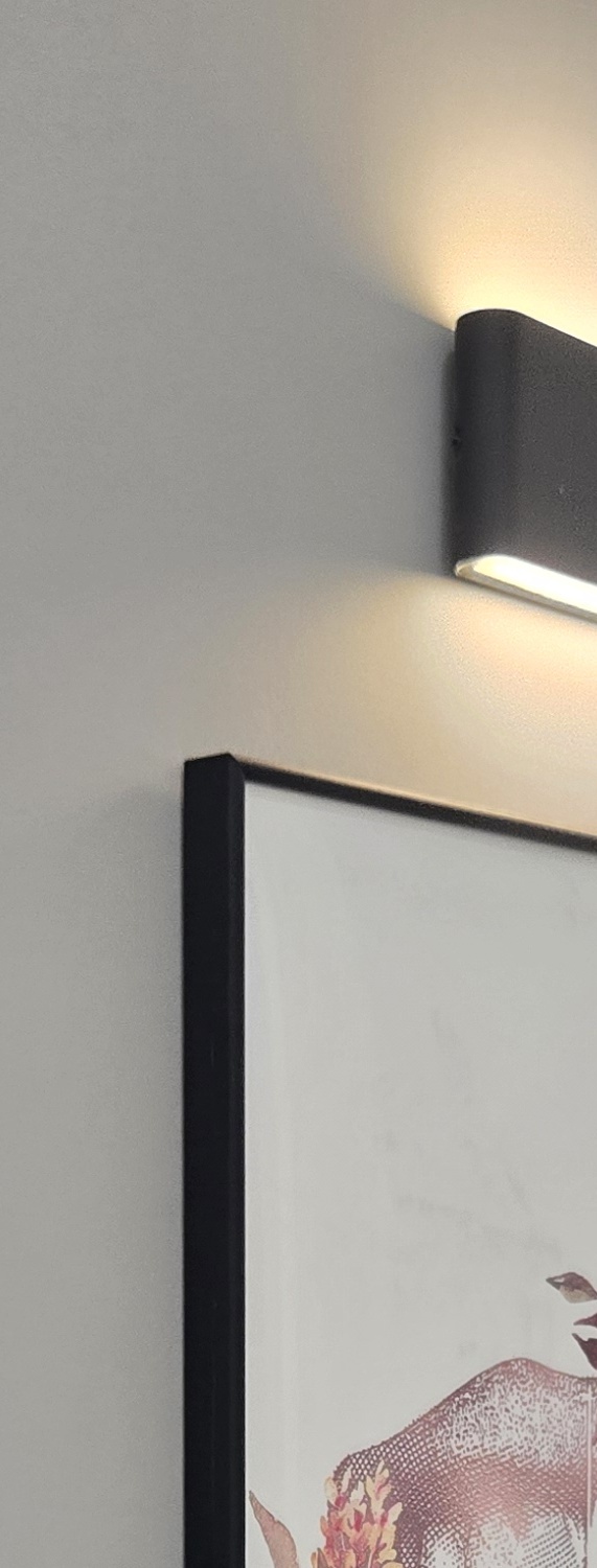 앞니 크라운 교체 깔끔하게 정리하려면 관련 이미지 32