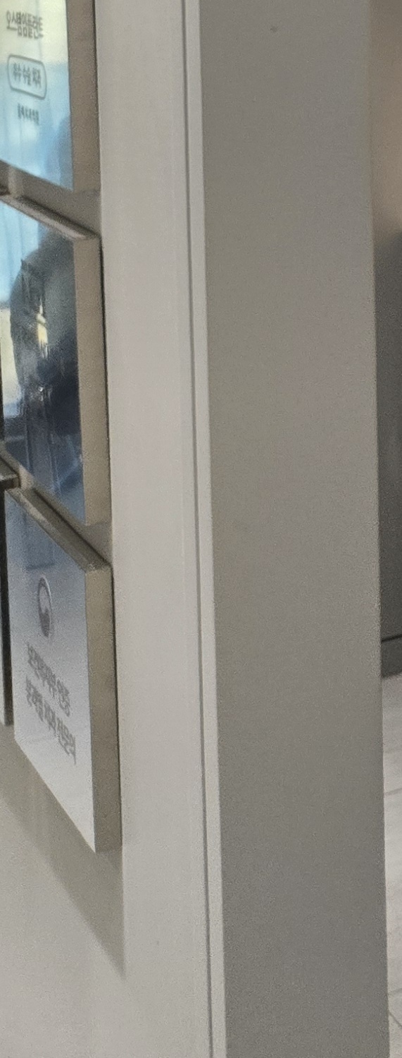 앞니 크라운 교체 깔끔하게 정리하려면 관련 이미지 36