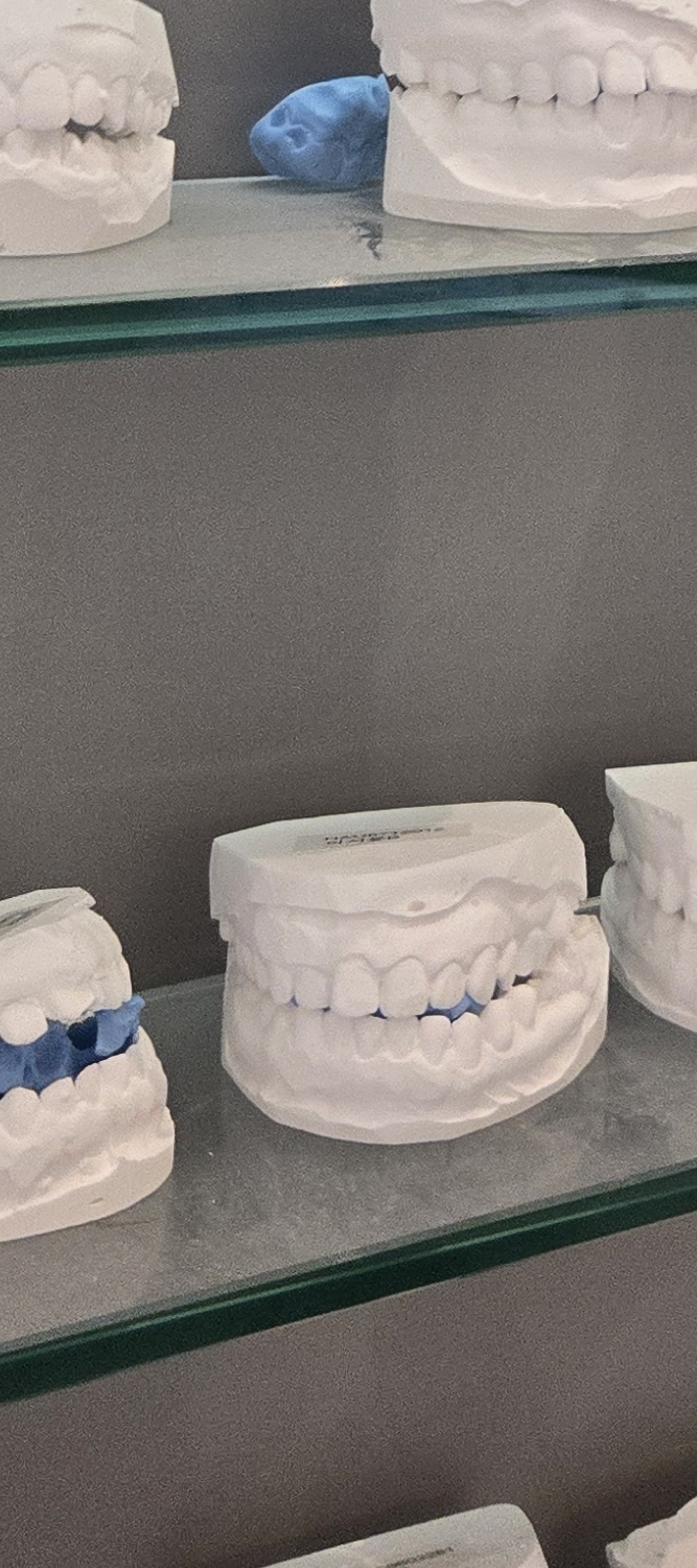 앞니 틀어짐 교정 이렇게 파악하세요 관련 이미지 18