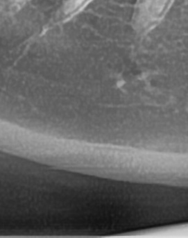 어금니 뒤 잇몸 부음 어떤 문제길래 이런거죠 관련 이미지 41