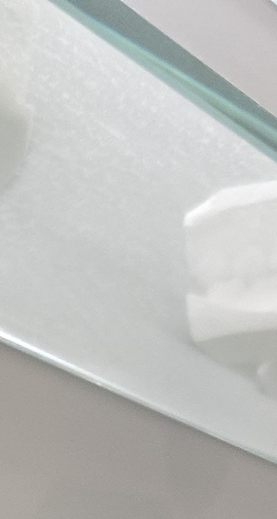 앞니 틀어짐 부분교정 얼마나 걸릴까 관련 이미지 17