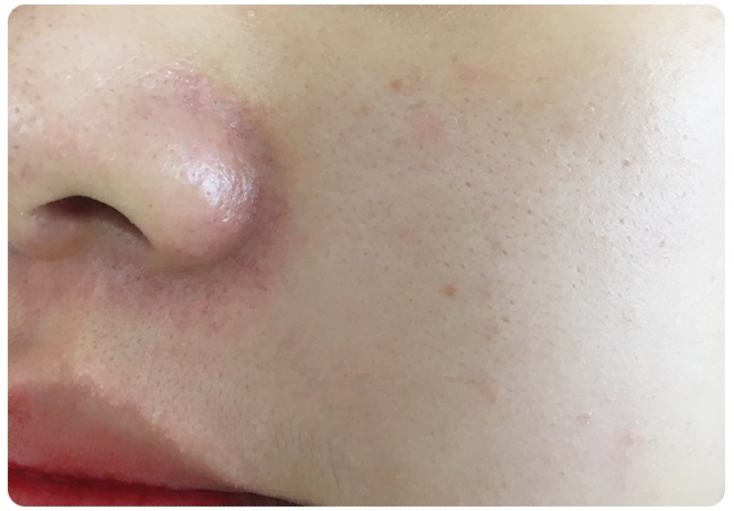 얼굴필링! 가을철얼굴각질제거에는 이게 특효죠 관련 이미지 1