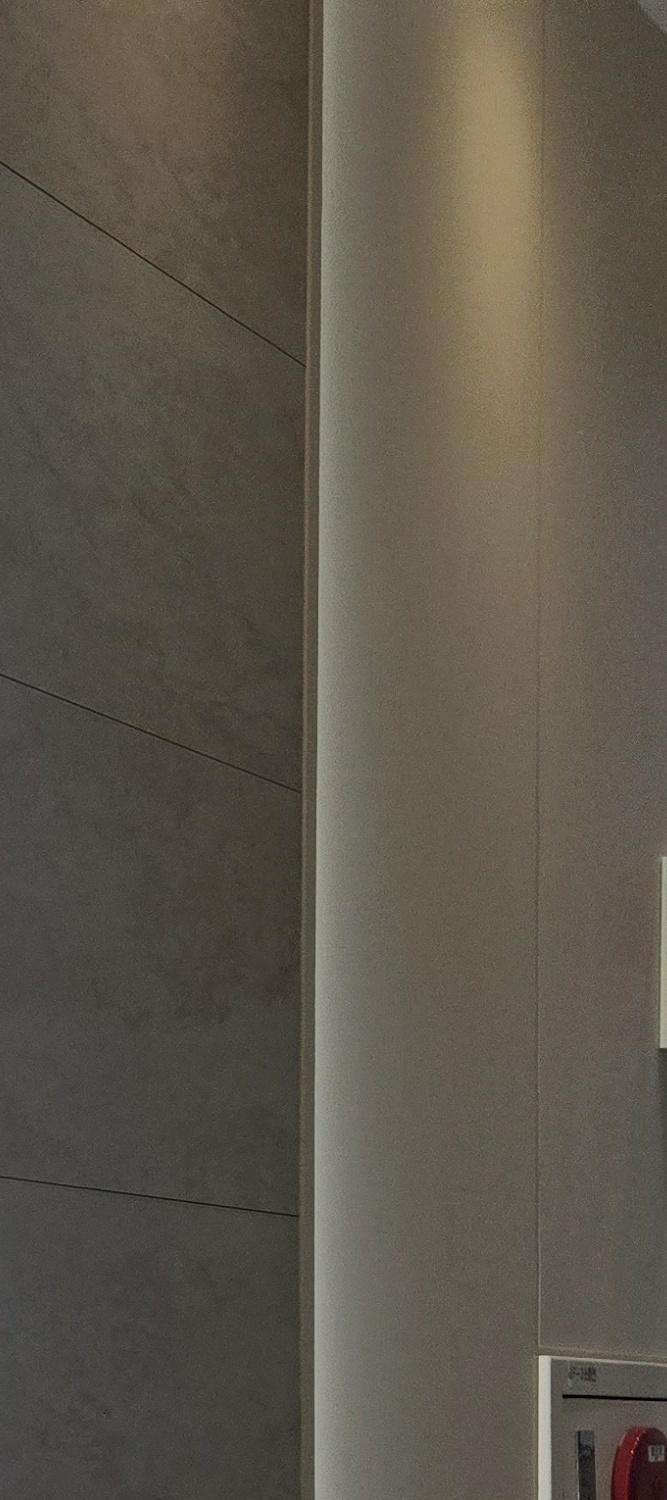 돌출 앞니 교정 이렇게 준비하세요 관련 이미지 14