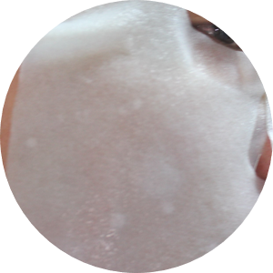 피부속당김 잠깐만 집중해주면 해결되요 관련 이미지 11