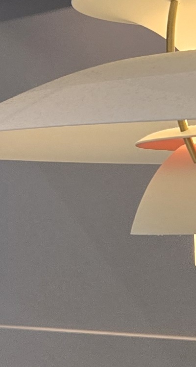 인레이 치료 후 통증 자꾸 심해지는데 괜찮은걸까 관련 이미지 37