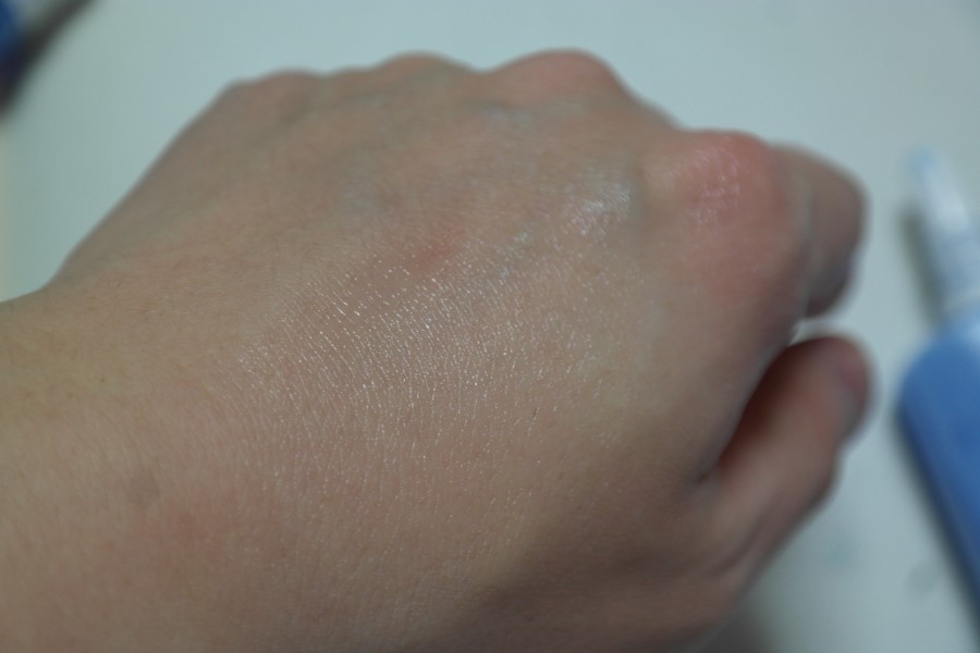 트러블피부화장품 레이저 시술후에 더 좋은 유수분공급세럼 관련 이미지 11