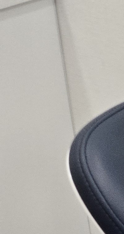 치아 사이 벌어짐 심해지는 이유부터 알아보면 관련 이미지 10