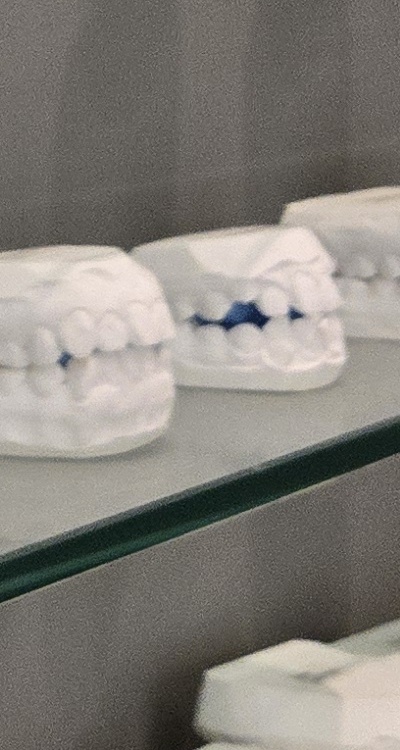 사랑니 주변 잇몸 통증 지금부터가 중요하니까 관련 이미지 39