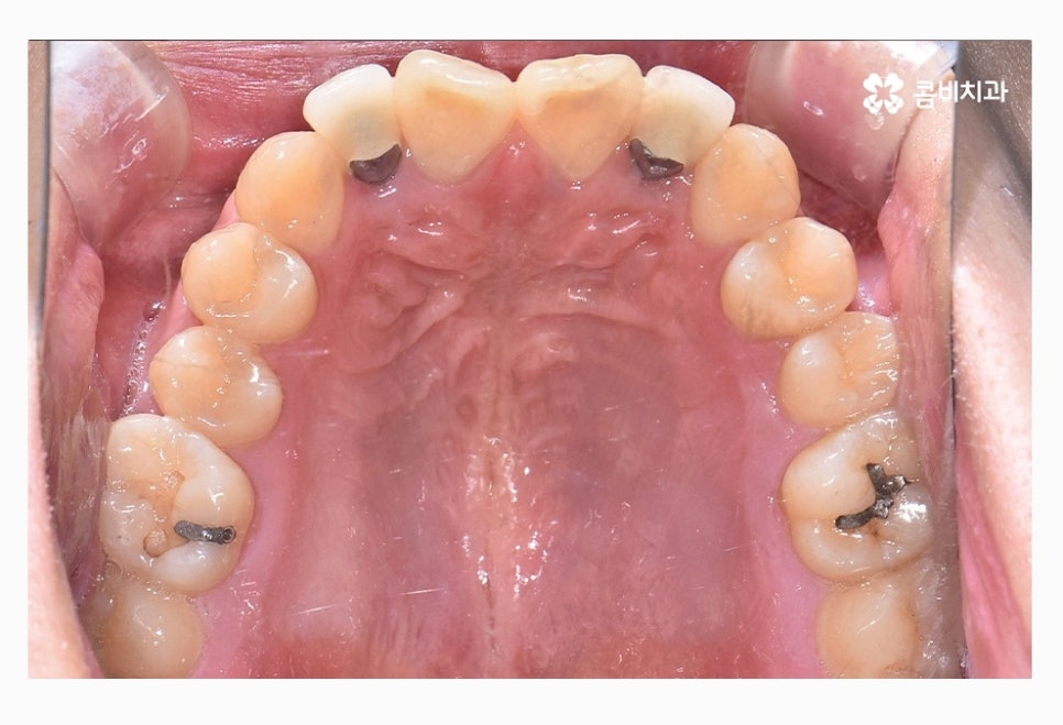 콤비교정 올바르게 판단하려면 관련 이미지 4