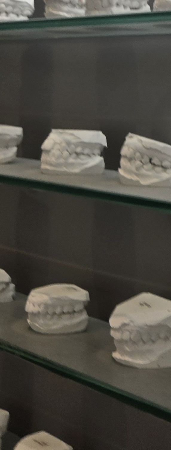 치과 치아미백 효과 어떤식으로 나타날까 관련 이미지 39