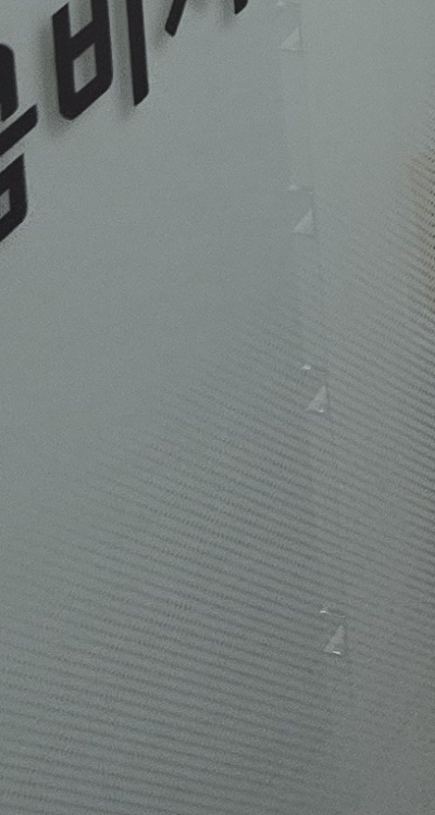 충치 검은점 나타났다면 이렇게 대처해요 관련 이미지 44