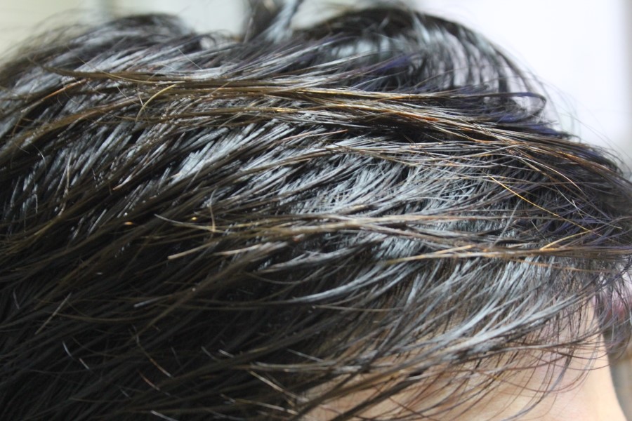 비듬샴푸추천 두피가 건강해지는 테라피션 릴렉싱 샴푸 관련 이미지 17