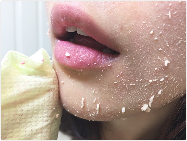 환절기 피부트러블 집에서 간편하게! 관련 이미지 9