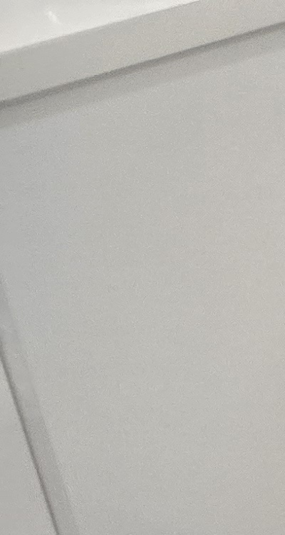 치아 사이 벌어짐 심해지는 이유부터 알아보면 관련 이미지 9