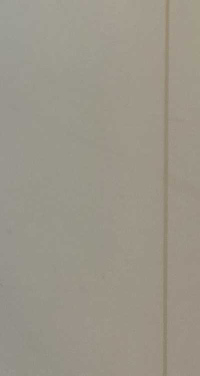 클리피씨교정 장단점 어떻게 비교하면 될까요 관련 이미지 37