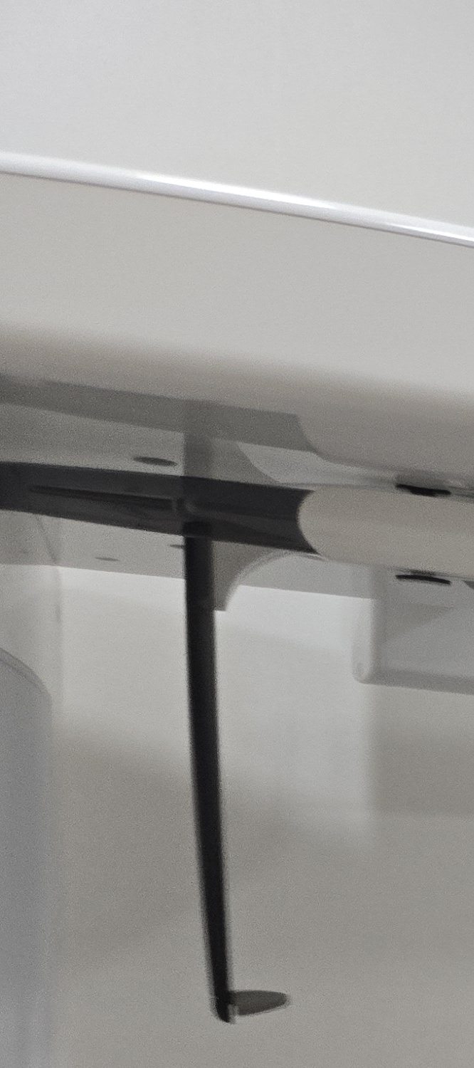 앞니 틀어짐 교정 이렇게 파악하세요 관련 이미지 22