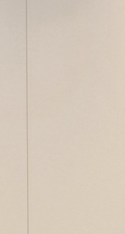 앞니 올세라믹 이건 알고 시작하세요 관련 이미지 14