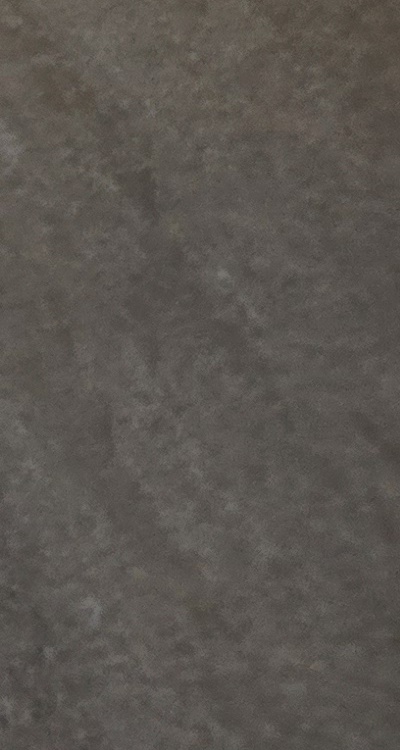 반대교합 치아교정 해결 가능할까 관련 이미지 37