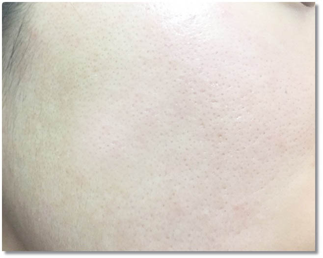 피부홈케어 최애템! 관련 이미지 8