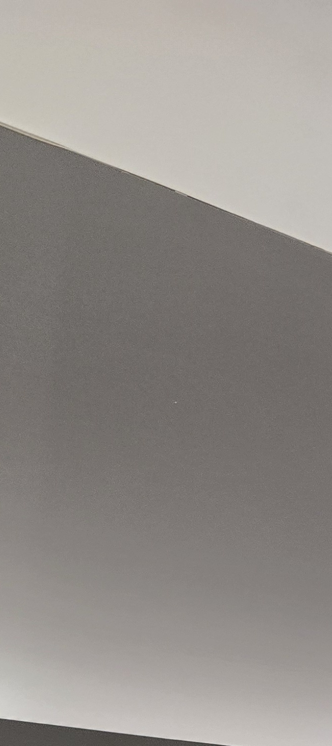 어금니 임플란트 뼈이식 이럴때 해당됩니다 관련 이미지 22