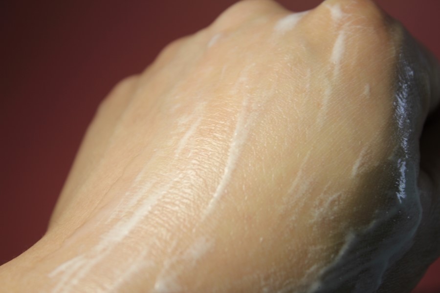 약산성폼클렌징 문제성피부에 딱 쓰기좋은 세안제 관련 이미지 9