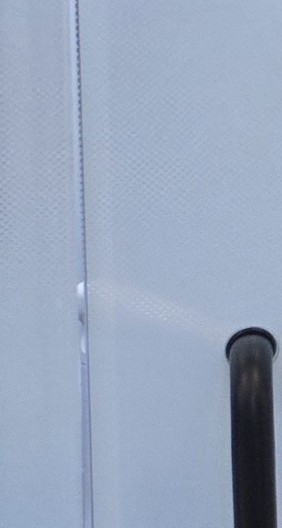 사랑니 발치 후 충치 치료 둘다 준비하려면 관련 이미지 31