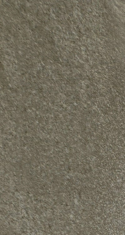 앞니 신경치료 크라운 까지 해야할 상황이라면 관련 이미지 12