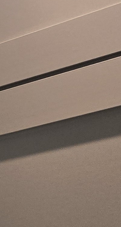 인레이 치료 후 통증 자꾸 심해지는데 괜찮은걸까 관련 이미지 30