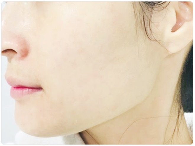 필링패드 원조는 달라요! 관련 이미지 6