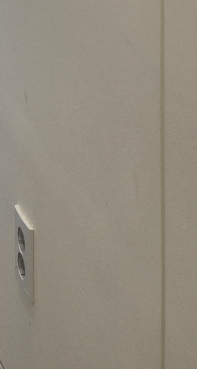 클리피씨교정 장단점 어떻게 비교하면 될까요 관련 이미지 47