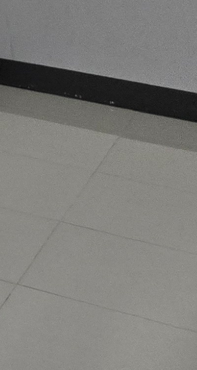 치아 발치 후 임플란트 언제부터 준비할까 관련 이미지 52