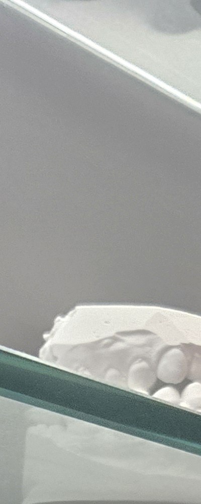 어르신 임플란트 지원 현명하게 활용하려면 관련 이미지 18