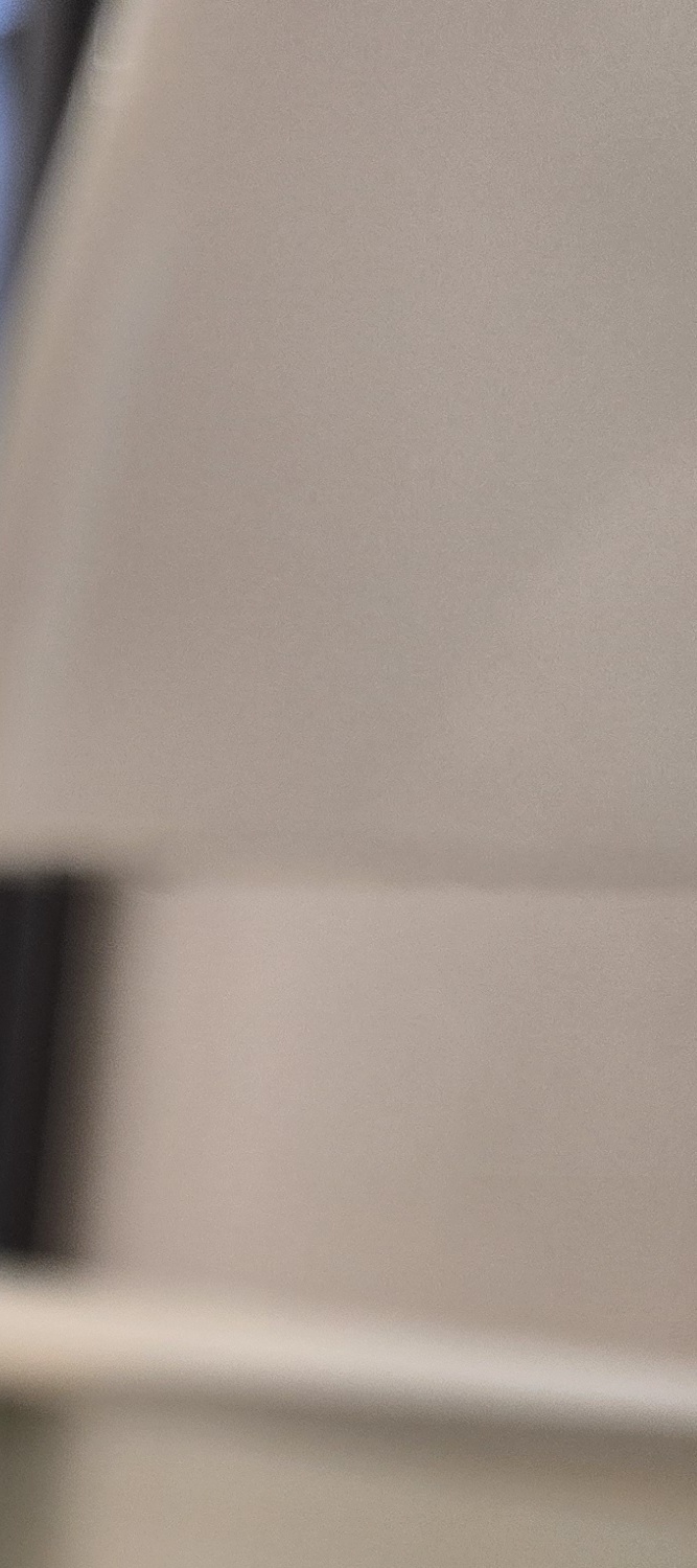 송곳니 덧니 발치 이럴때 해당되네요 관련 이미지 17