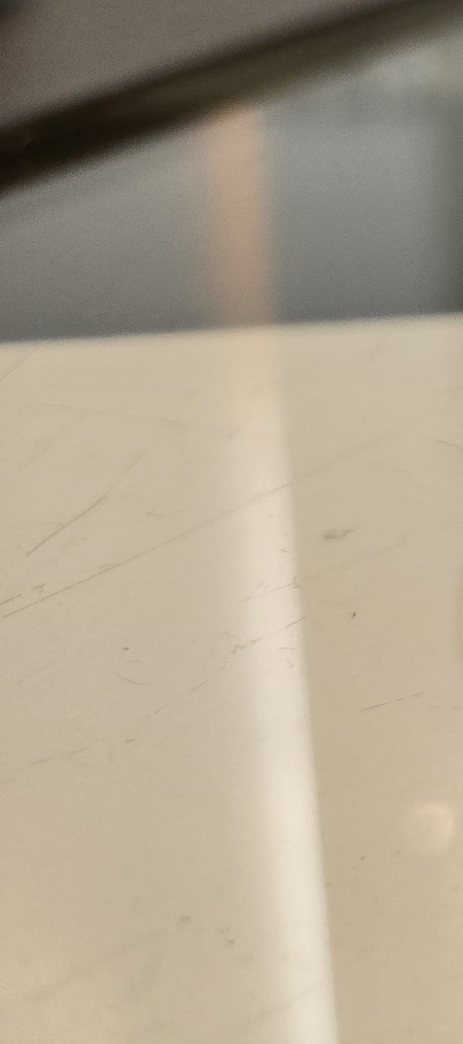 송곳니 덧니 발치 이럴때 해당되네요 관련 이미지 18