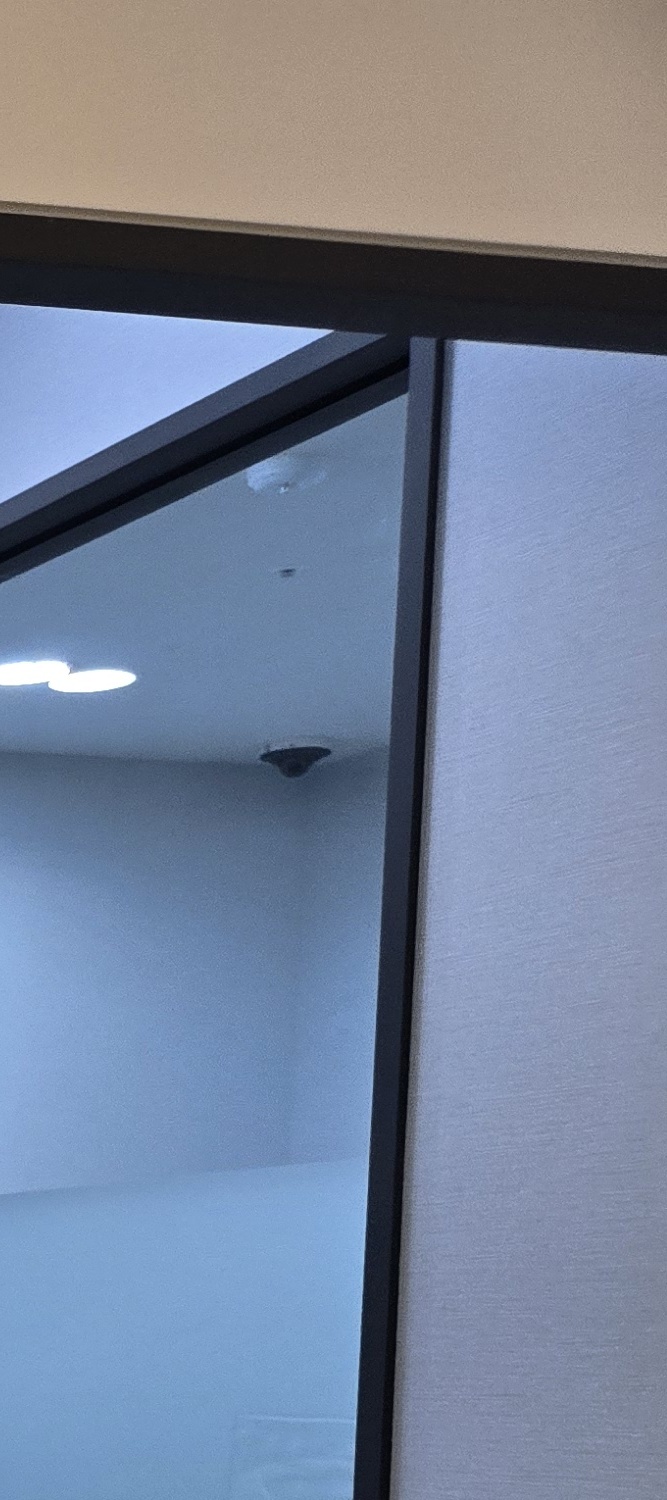 아말감 교체 시기 이렇게 따져보세요 관련 이미지 18