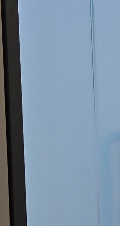 아말감 교체 레진 인레이 어떻게 대처하면 될까 관련 이미지 35