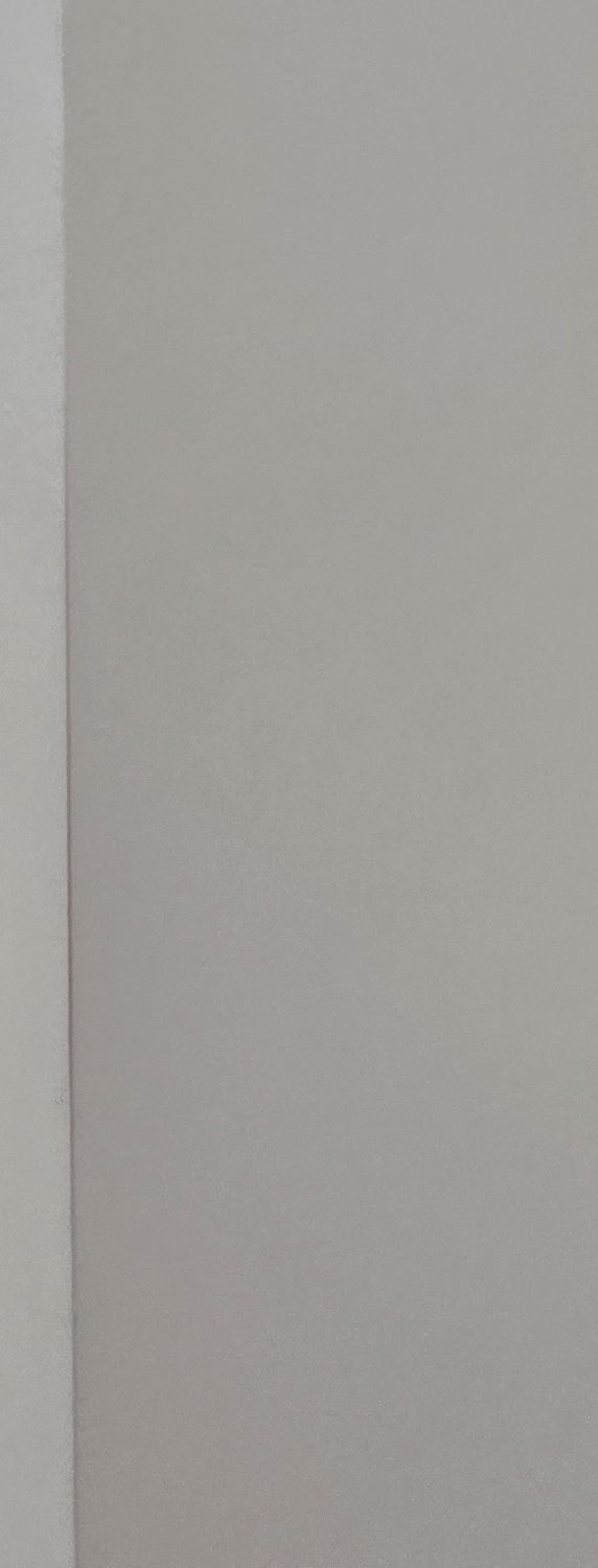 앞니 크라운 교체 깔끔하게 정리하려면 관련 이미지 38