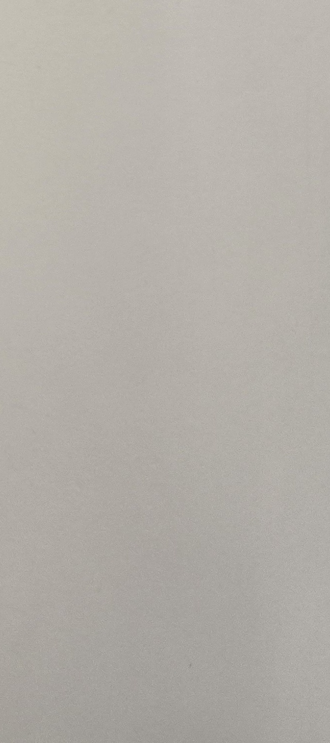 어금니 임플란트 과정 기간 어느정도 예상되나요 관련 이미지 22