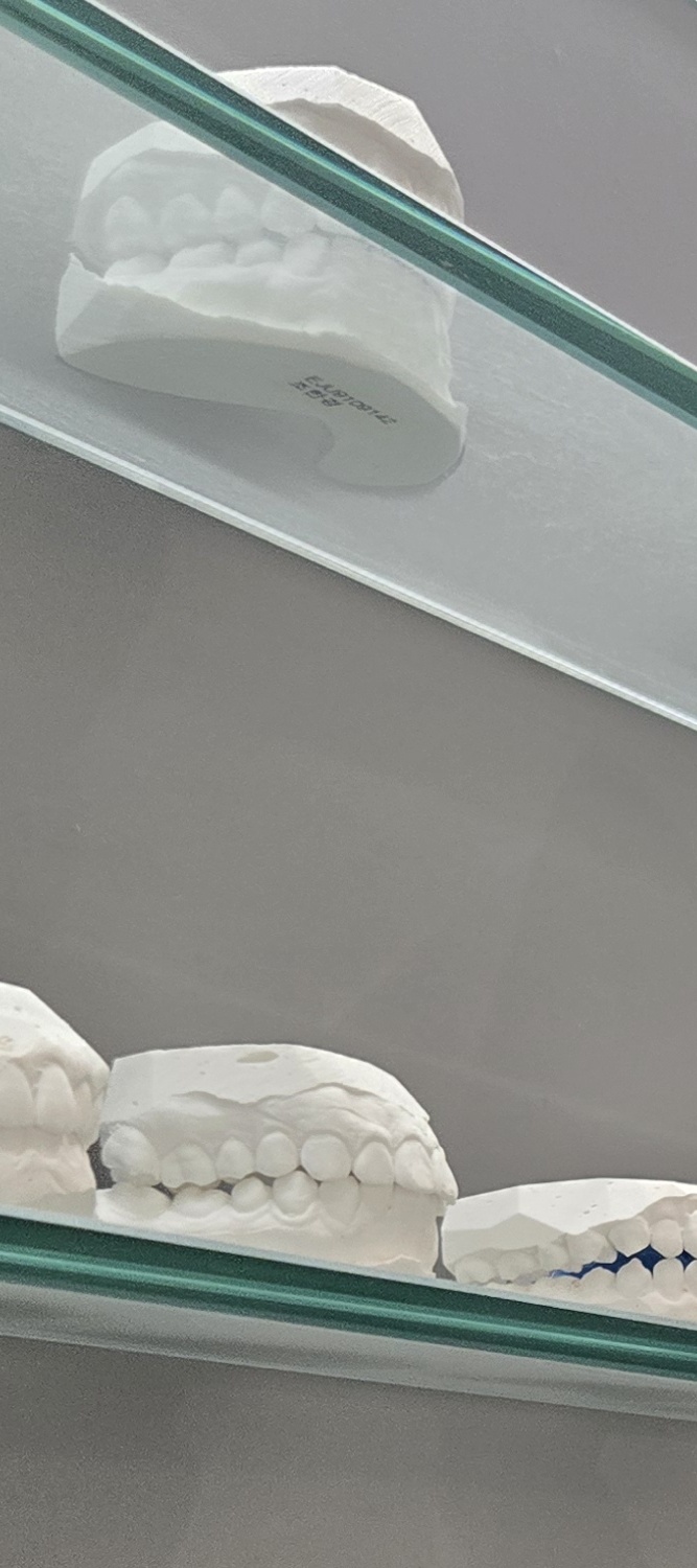 오래된 보철물 아말감 교체 어떠한 케이스일까 관련 이미지 12