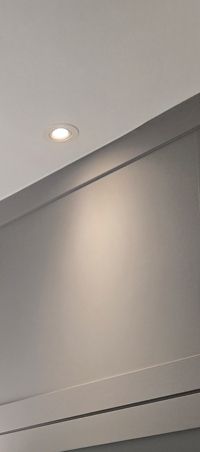 어금니 임플란트 뼈이식 이럴때 해당됩니다 관련 이미지 24