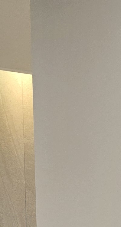 앞니 부분 교정 간단하니까 좋은건가요 관련 이미지 17