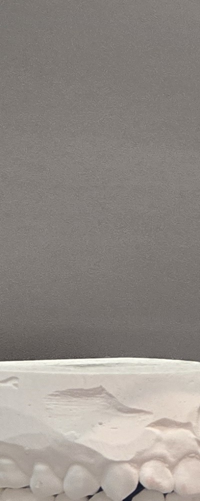 어르신 임플란트 지원 현명하게 활용하려면 관련 이미지 26