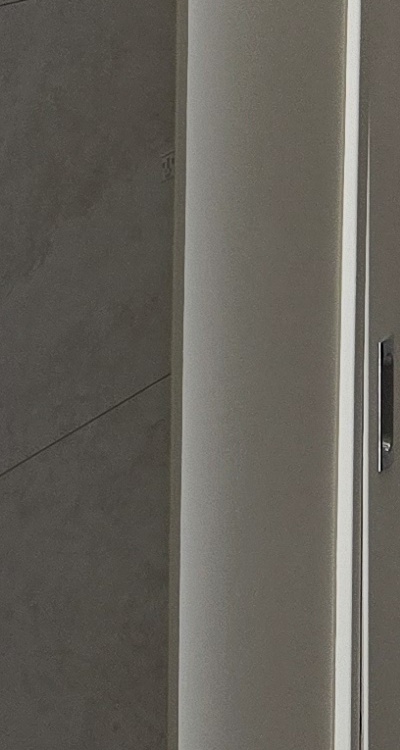 앞니 틀어짐 교정 조화롭게 마무리하려면 관련 이미지 35