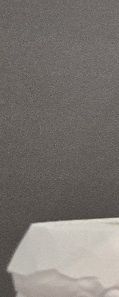 어르신 임플란트 지원 현명하게 활용하려면 관련 이미지 23