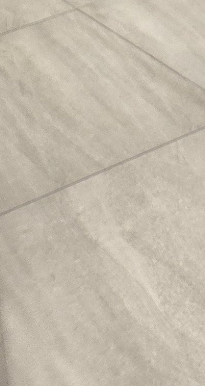 송곳니 크라운 티가 안나게 해결 가능한건가요 관련 이미지 40