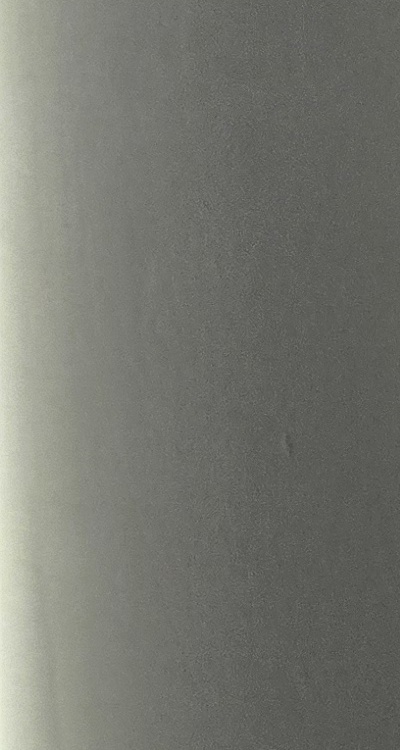 앞니 틀어짐 교정 조화롭게 마무리하려면 관련 이미지 29